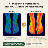 ReNerv 3D - EMS-Stimulationsgerät bei Taubheit, Kribbeln und Missempfindungen